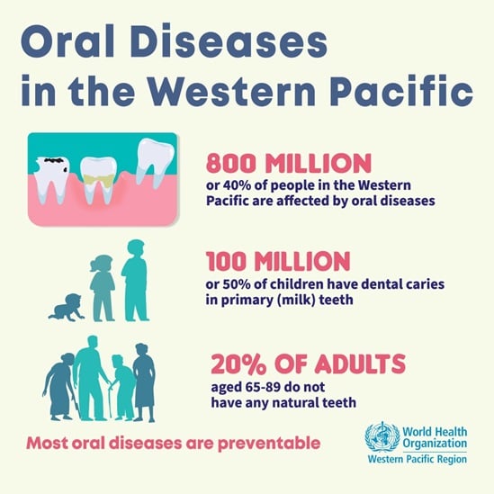 Burden of oral diseases in the Western Pacific